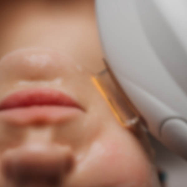 Option 5: BBL Face, Neck and Decollete treatment Package