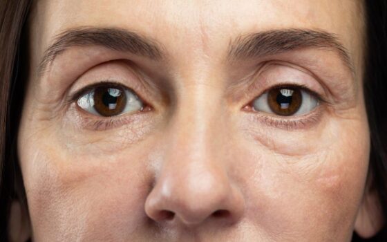 The Difference Between Looking Tired and Looking Older